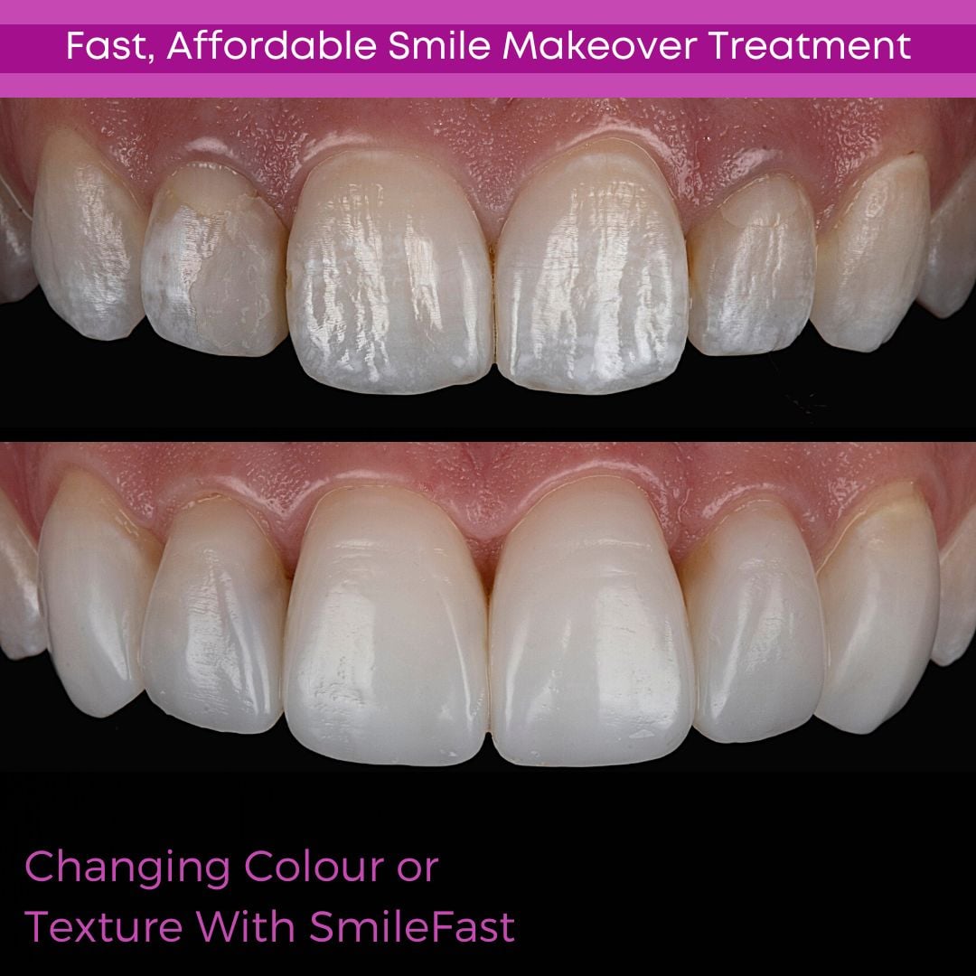 Dentistry On The Square, Pain Free Dentist Glasgow - SmileFast Dentistry On The Square, Pain Free Dentist Glasgow - SmileFast
