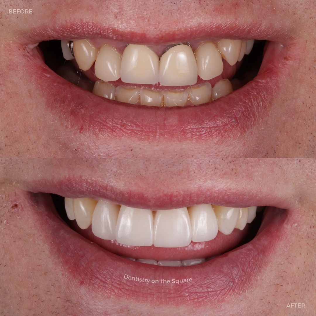 Dentistry On The Square, Pain Free Dentist Glasgow - Treatments Dentistry On The Square, Pain Free Dentist Glasgow - Treatments