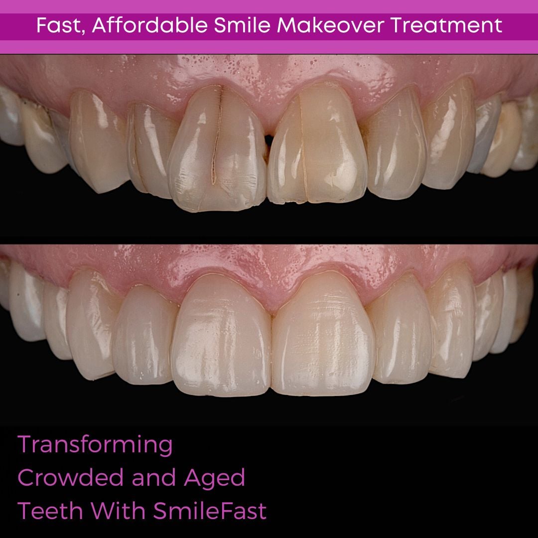Dentistry On The Square, Pain Free Dentist Glasgow - SmileFast Dentistry On The Square, Pain Free Dentist Glasgow - SmileFast