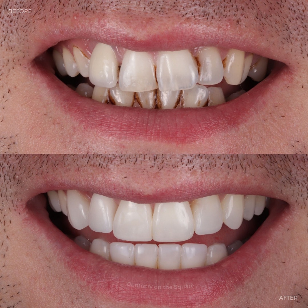 Dentistry On The Square, Pain Free Dentist Glasgow - Treatments Dentistry On The Square, Pain Free Dentist Glasgow - Treatments