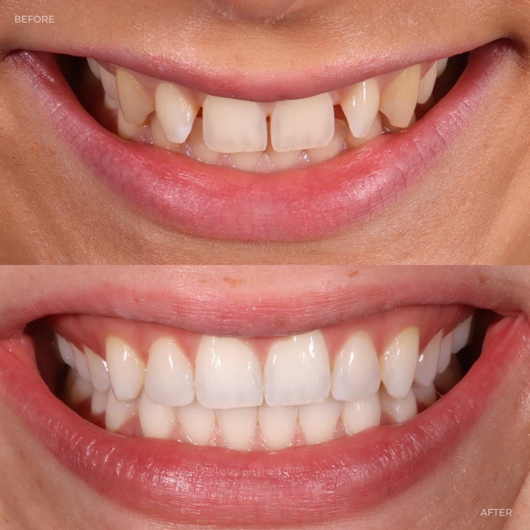 Dentistry On The Square, Pain Free Dentist Glasgow - Treatments Dentistry On The Square, Pain Free Dentist Glasgow - Treatments