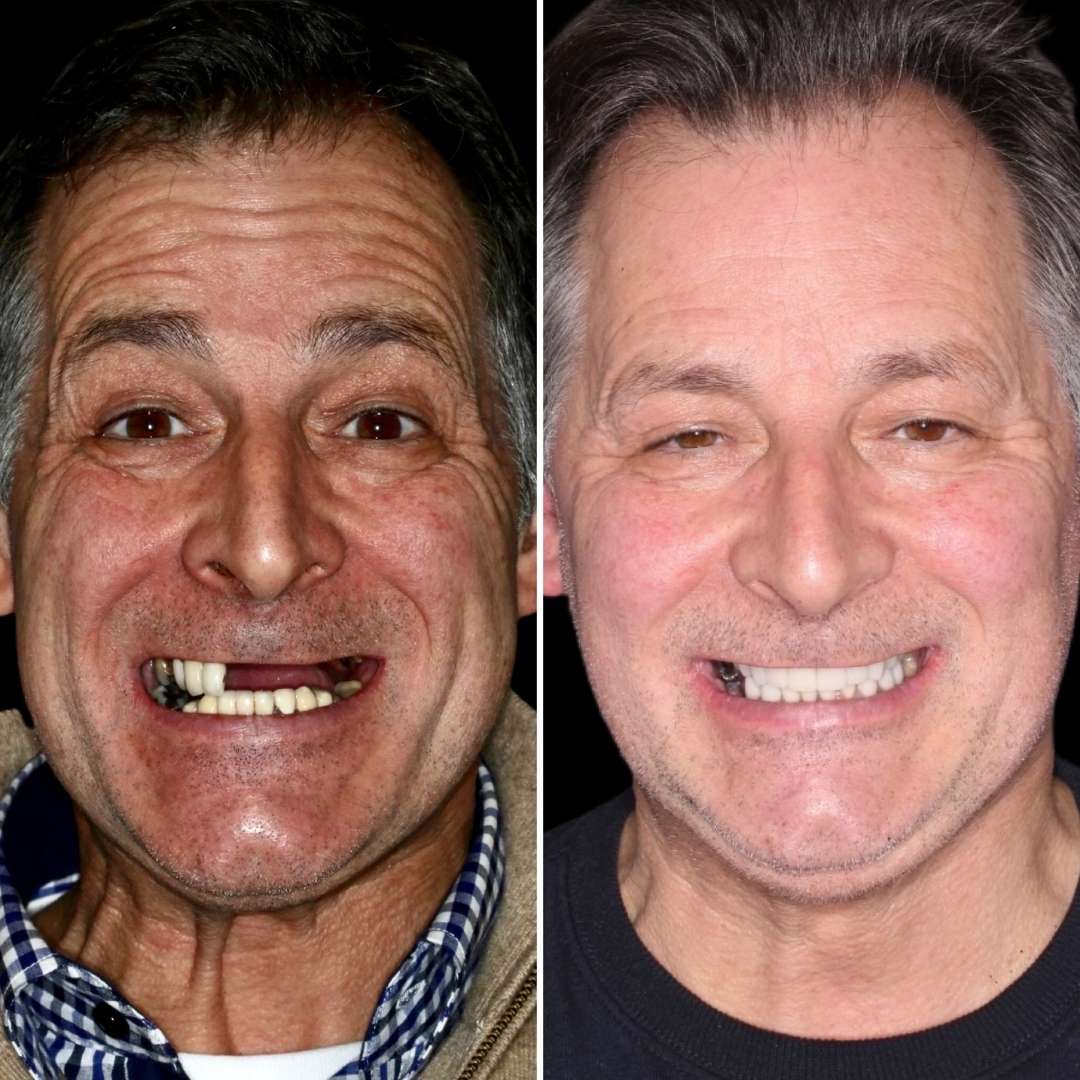 Before and after treatment