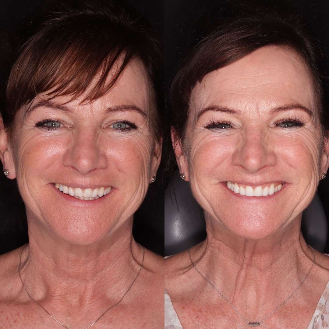 Before and after treatment