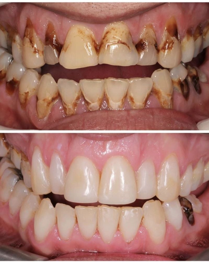 Dentistry On The Square, Pain Free Dentist Glasgow - Sarah Wallace