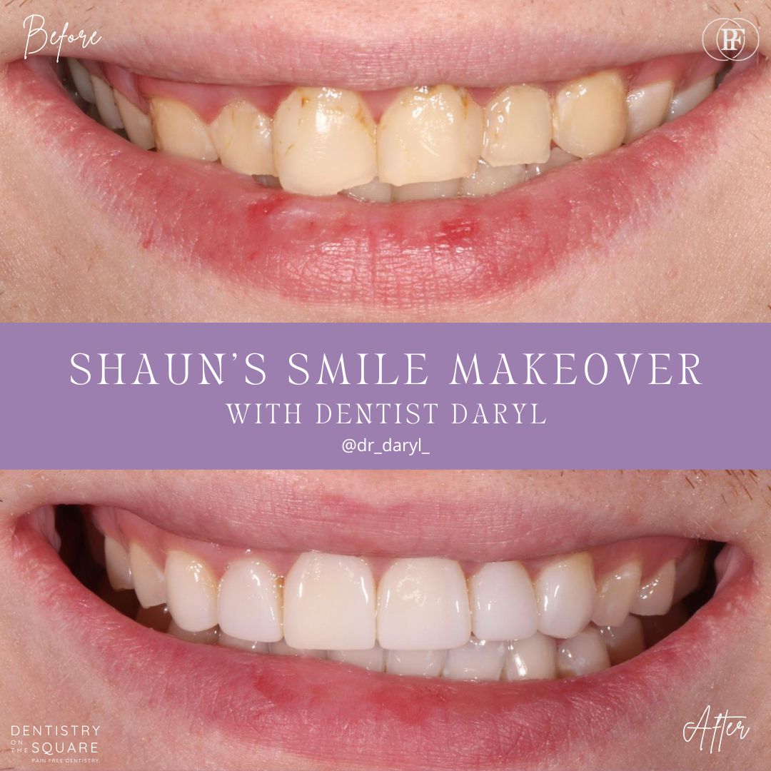 Shauns smile story