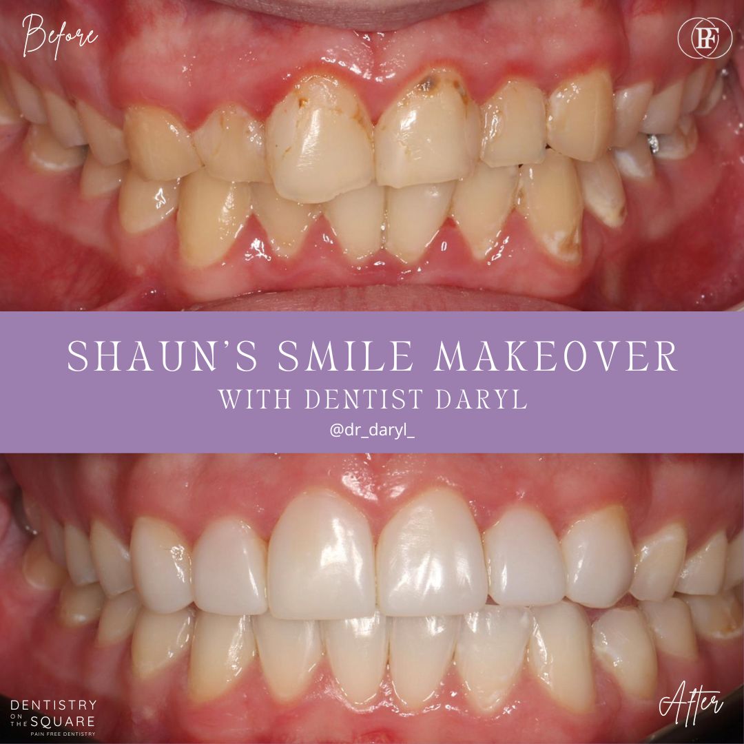 Shauns Smile Story