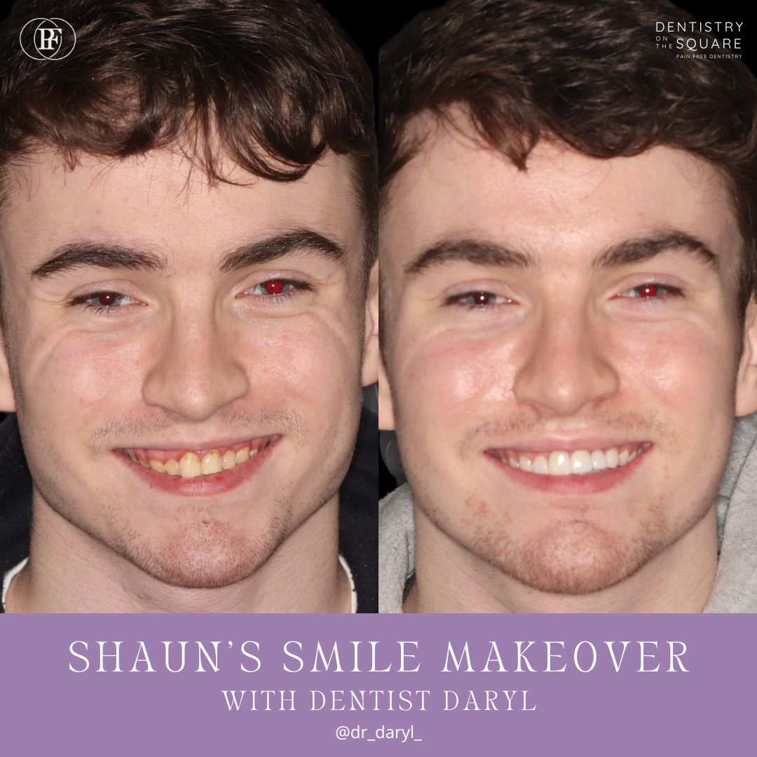 Shauns Smile Story