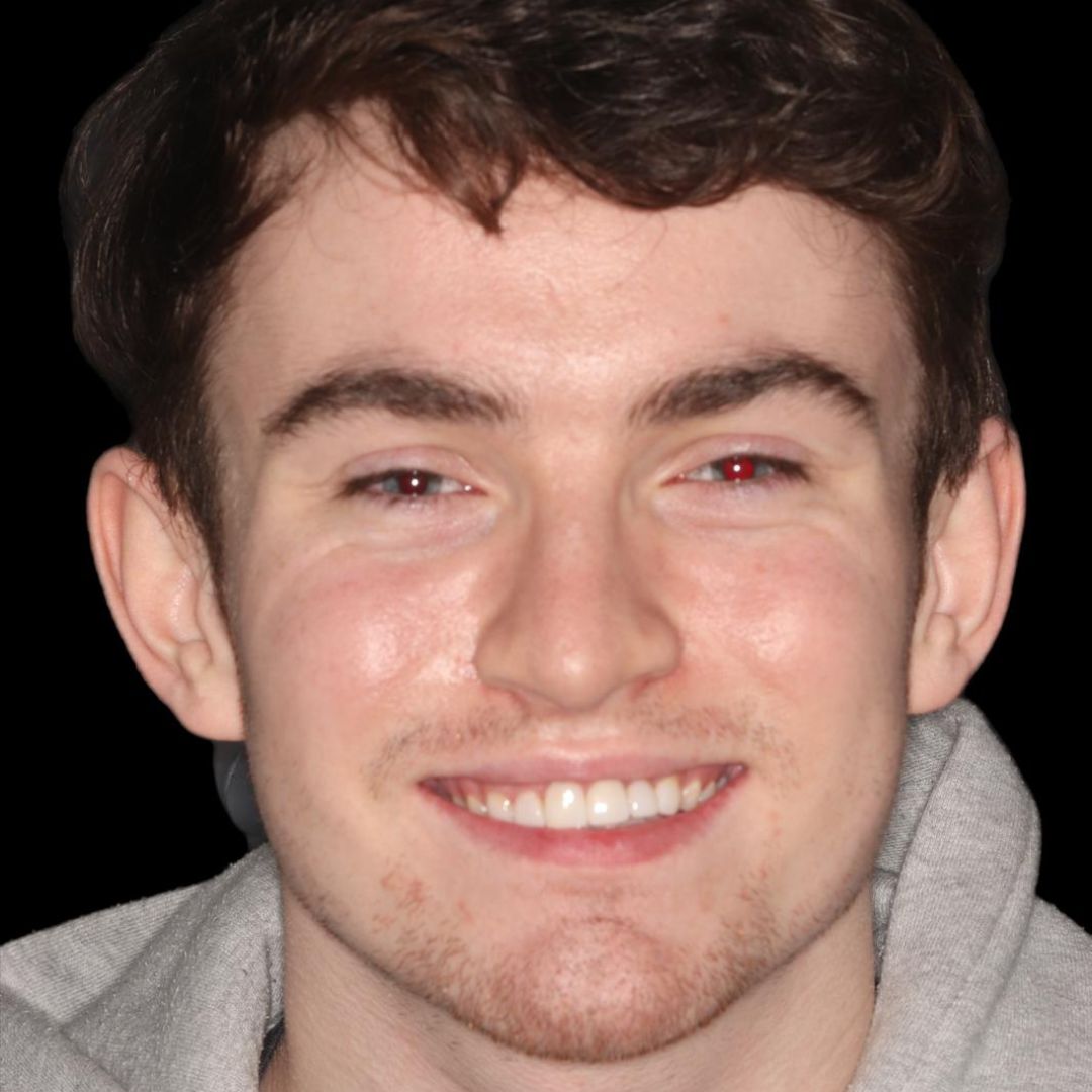 Shauns smile story
