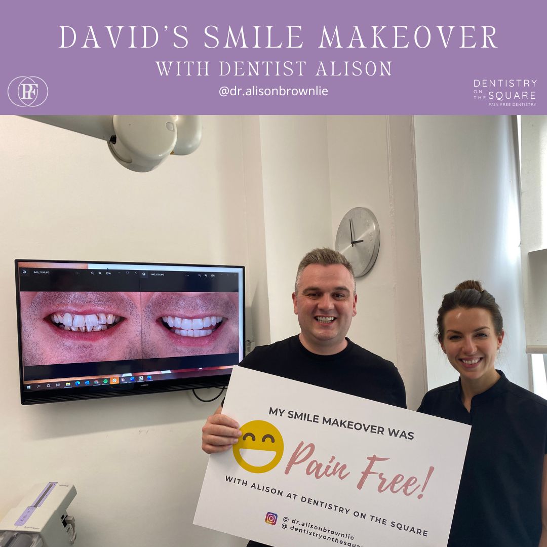 David's Smile Makeover