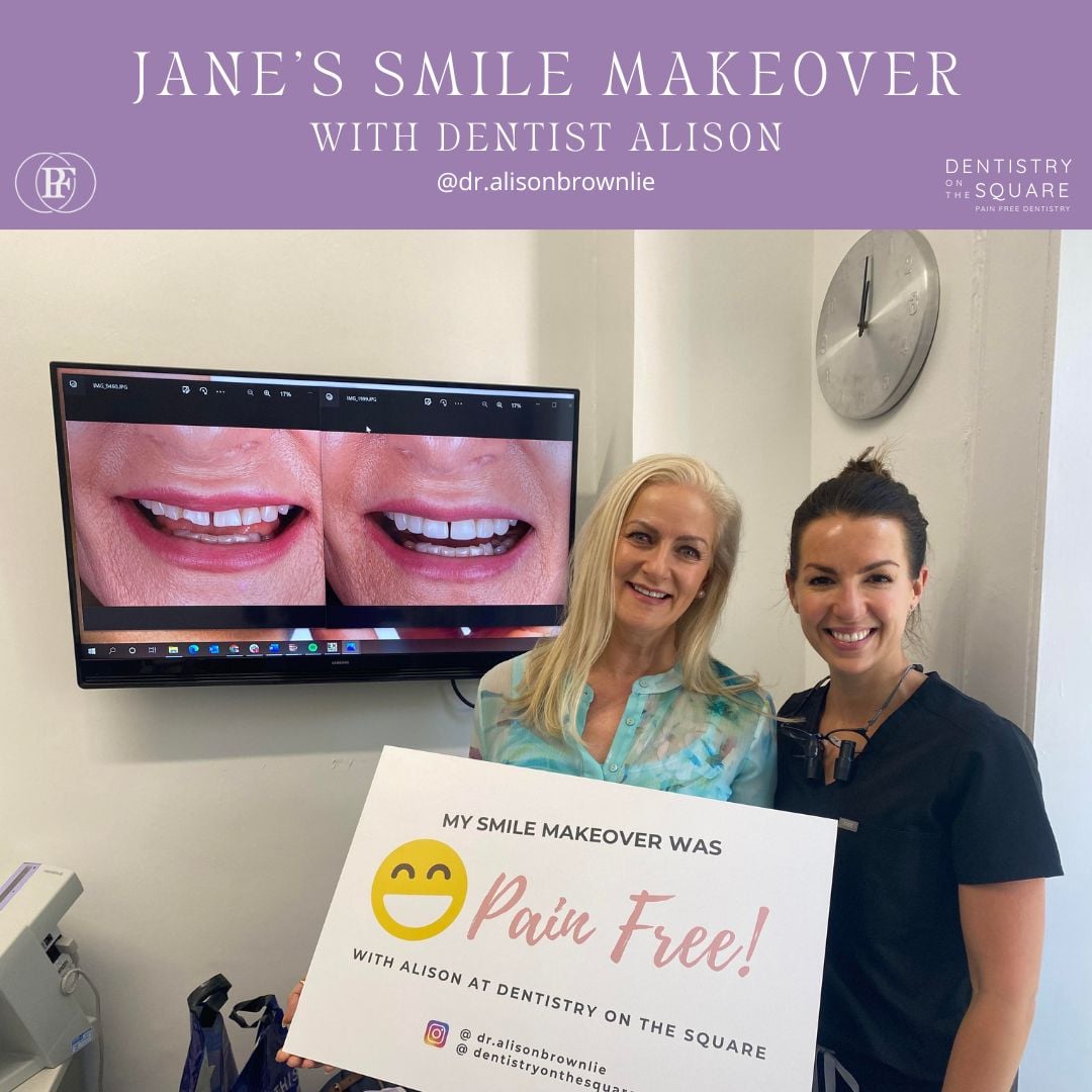 Jane's smile makeover