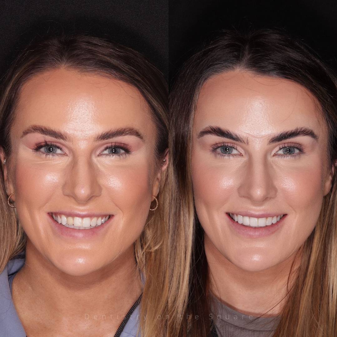 Dentistry On The Square, Pain Free Dentist Glasgow - Smile Gallery