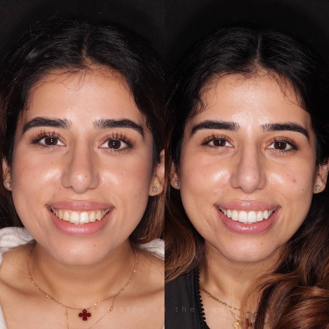 Dentistry On The Square, Pain Free Dentist Glasgow - Smile Gallery