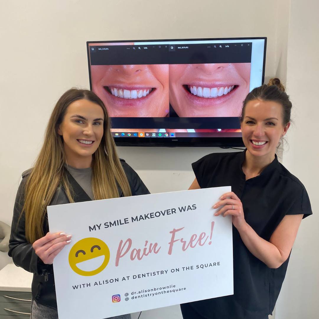 Dentistry On The Square, Pain Free Dentist Glasgow - OrthoFX Solutions Before and after treatment at Dentistry On The Square in Glasgow