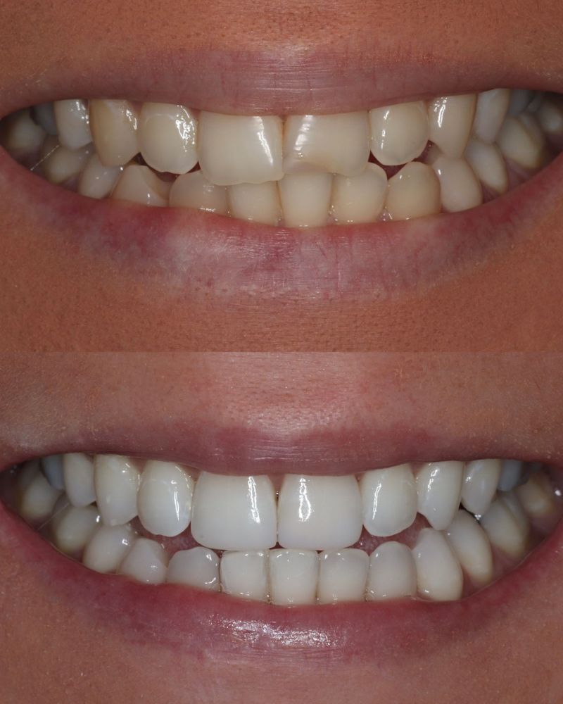 Before & after treatment with Andy