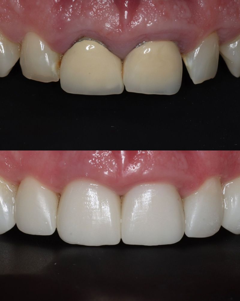 Before & after treatment with Andy