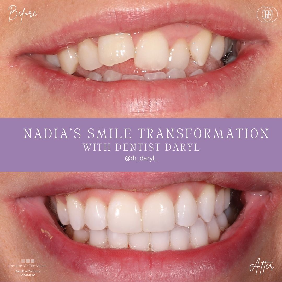Nadia´s smile story