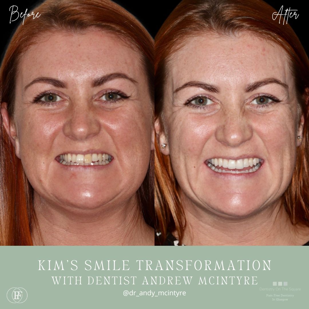 Kim's smile story