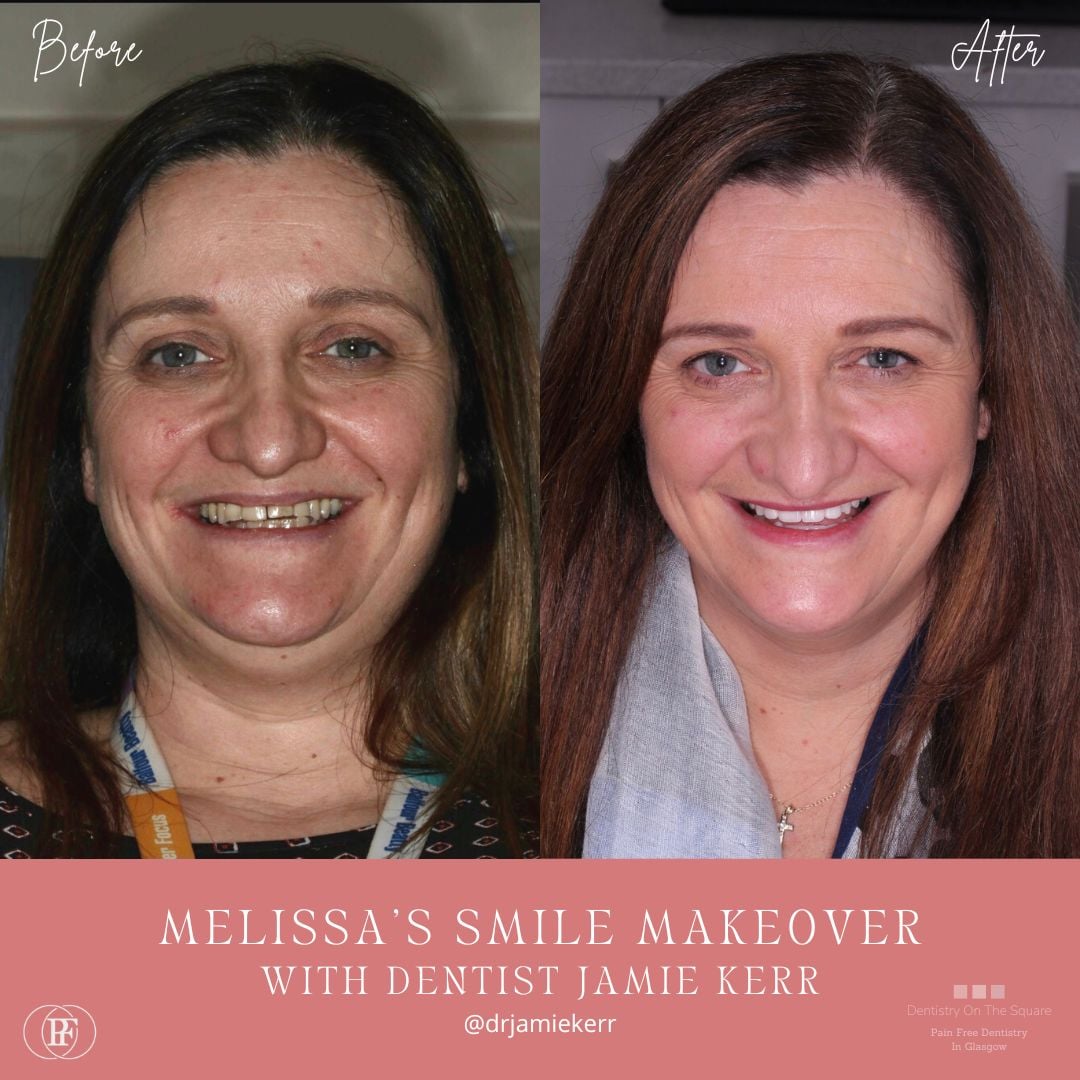 Dentistry On The Square, Pain Free Dentist Glasgow - Comfortable New Dentures