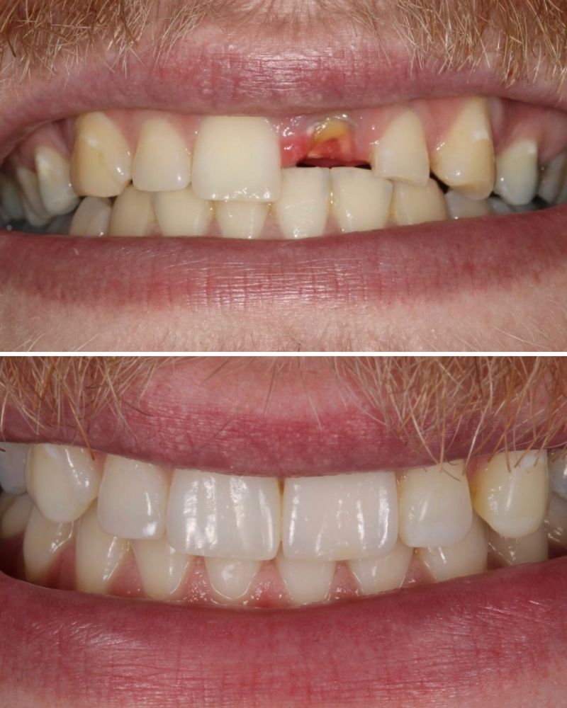 Dentistry On The Square, Pain Free Dentist Glasgow - Jamie Kinnell