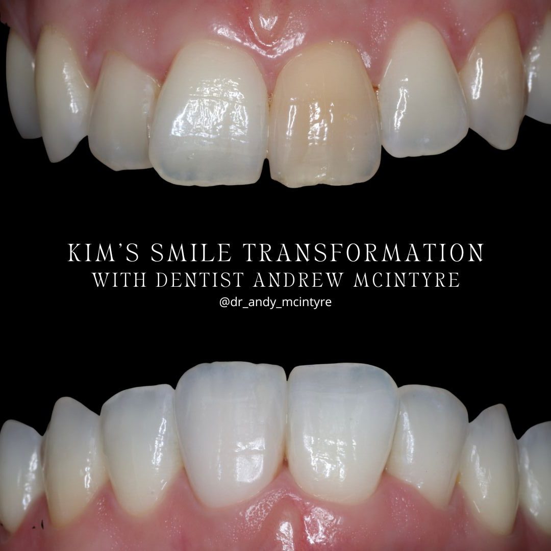 Dentistry On The Square, Pain Free Dentist Glasgow - Kim's Smile Story