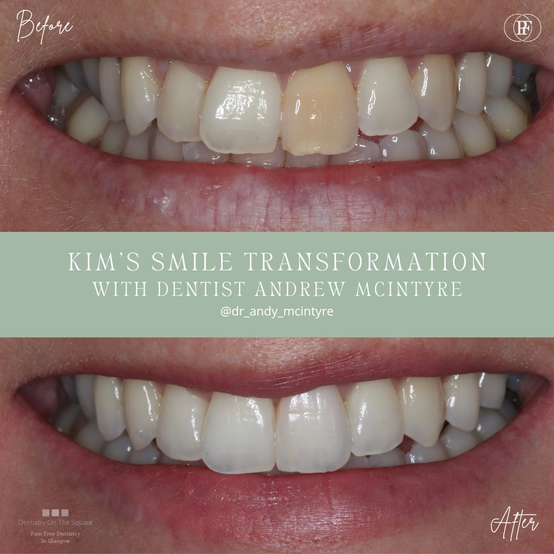 Kim's Smile Story with Andy