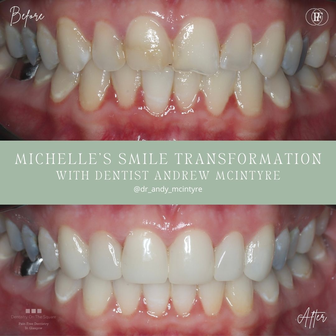 Michelle's Smile Story with Andy
