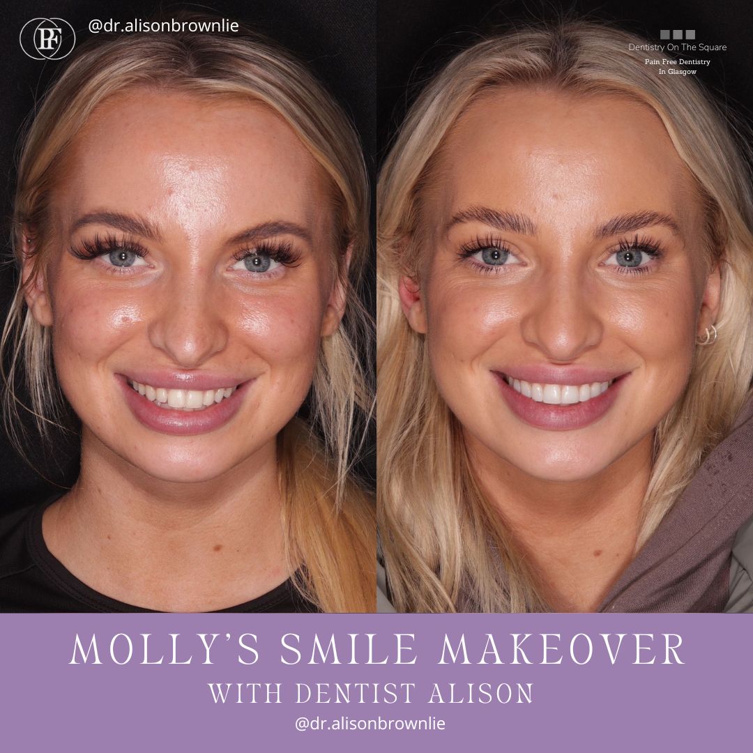 Jane's smile makeover