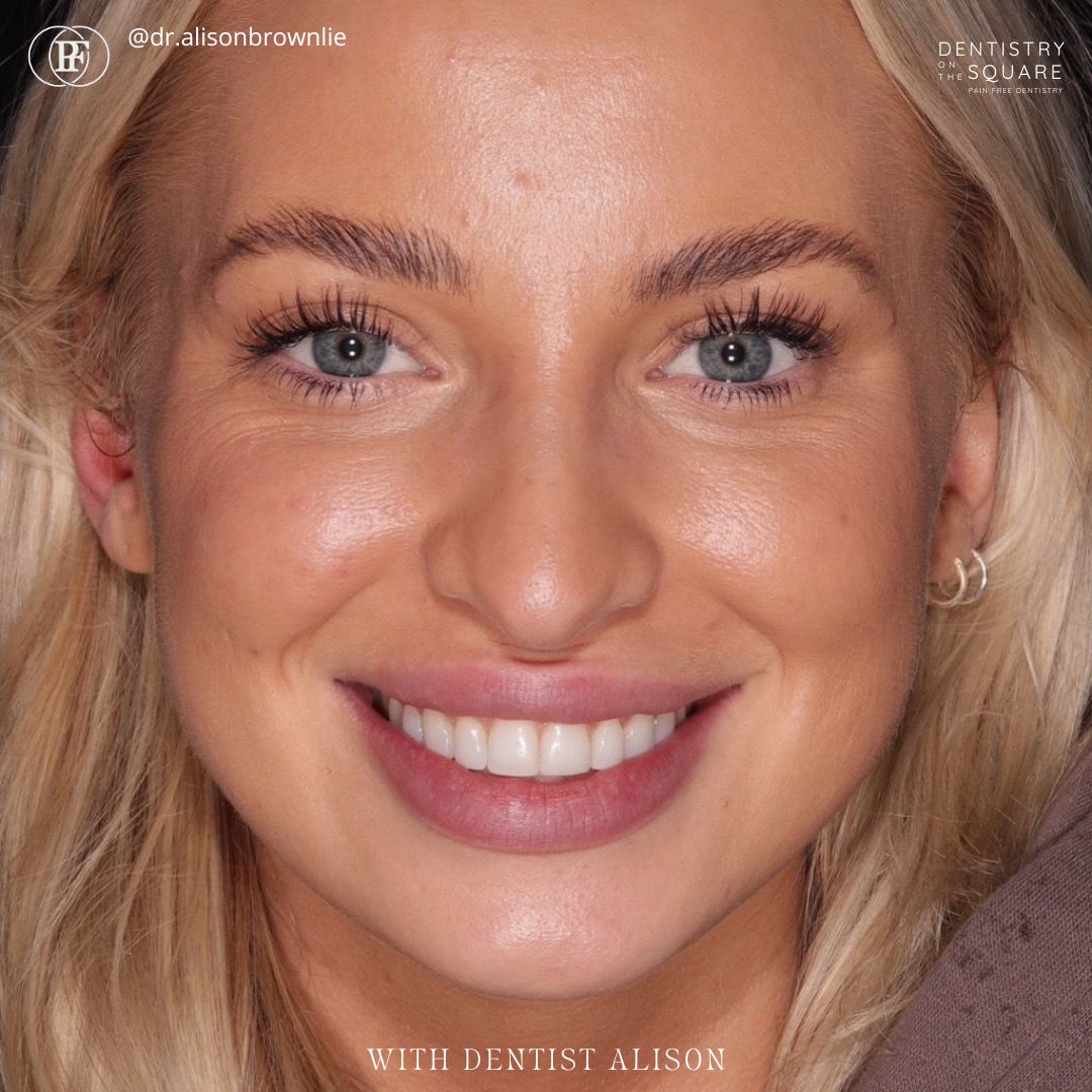 Jane's smile makeover