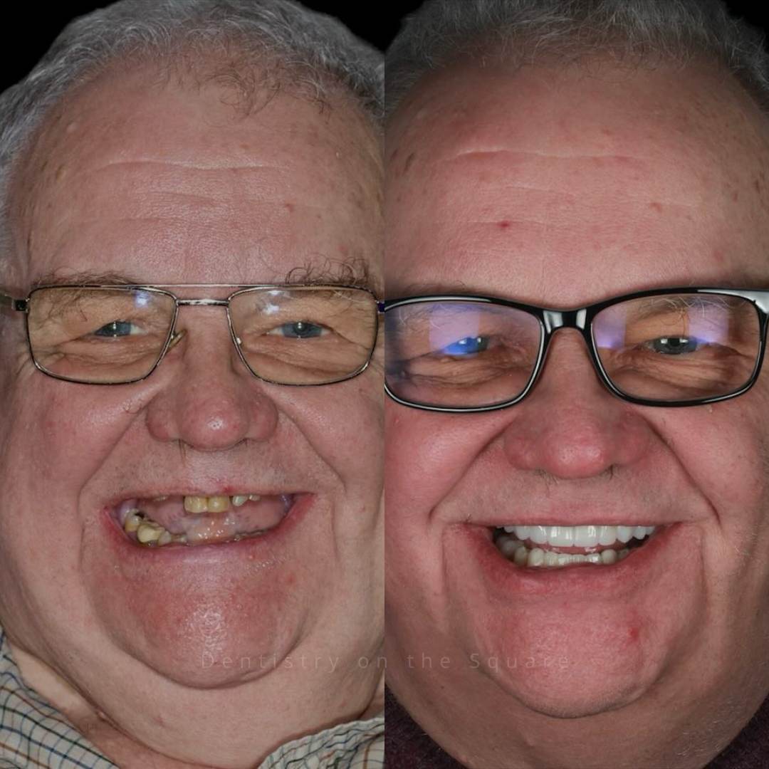 Dentistry On The Square, Pain Free Dentist Glasgow - Smile Gallery
