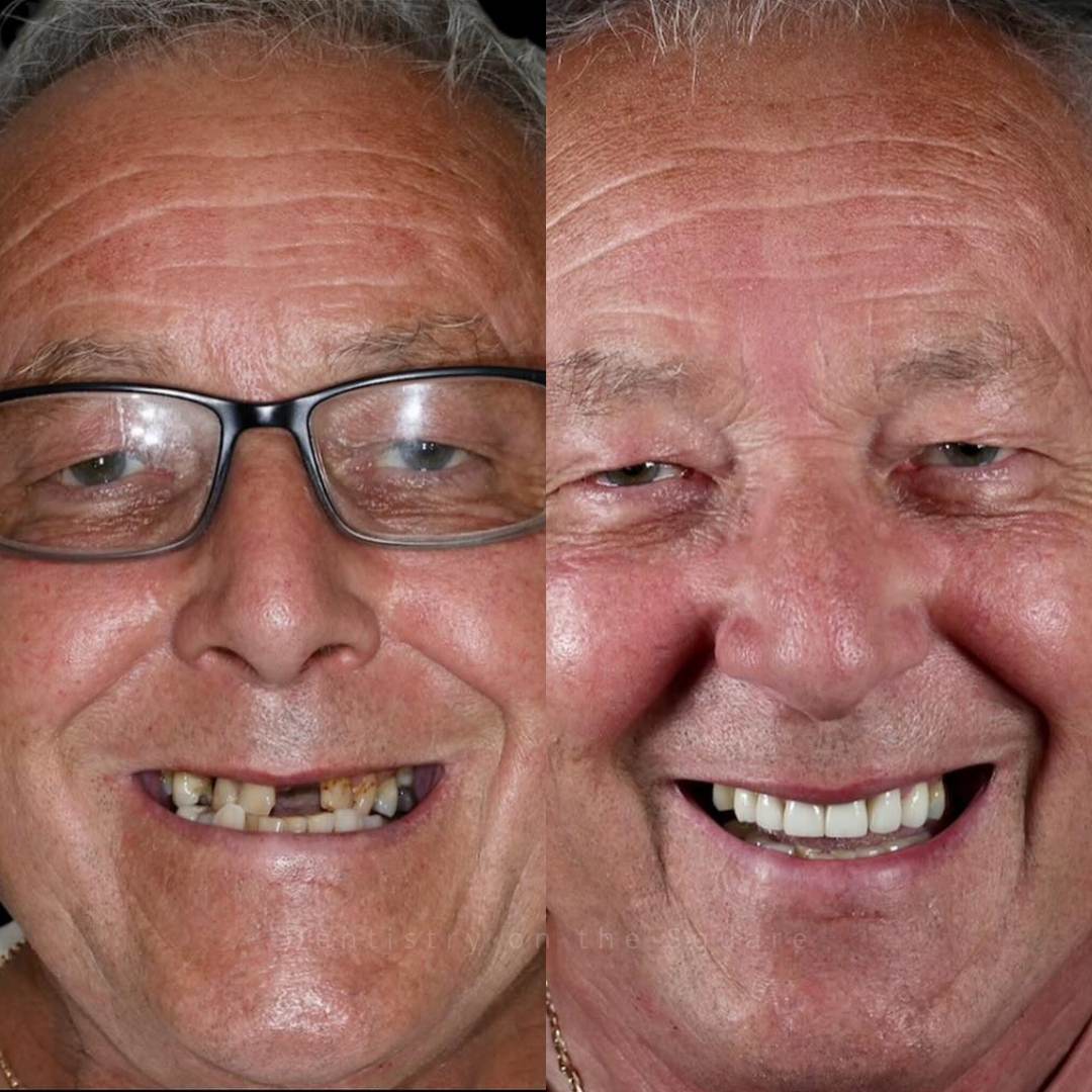 Dentistry On The Square, Pain Free Dentist Glasgow - Smile Gallery
