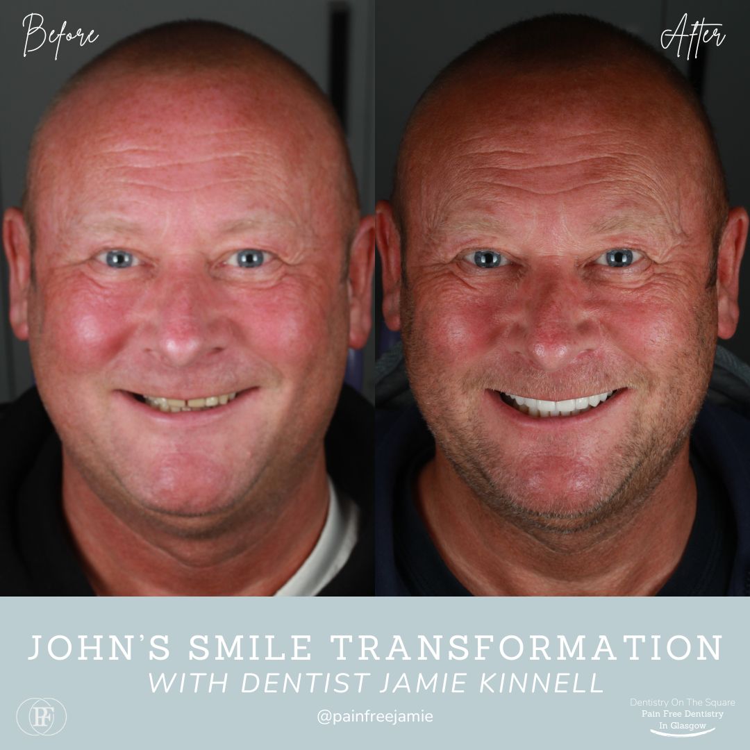 Dentistry On The Square, Pain Free Dentist Glasgow - John's Smile Story