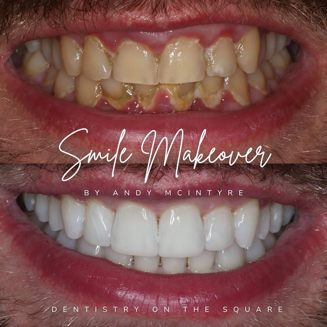 Dentistry On The Square, Pain Free Dentist Glasgow - Smile Makeovers in Glasgow