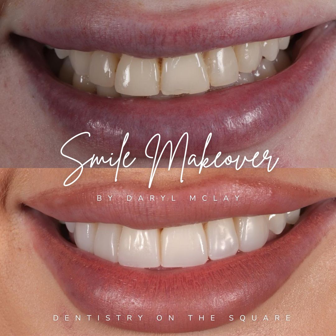 Dentistry On The Square, Pain Free Dentist Glasgow - Smile Makeovers in Glasgow