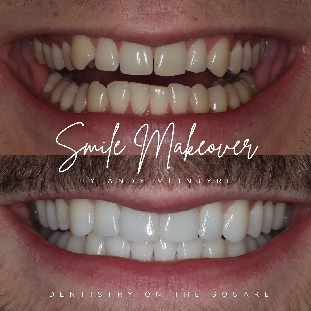Dentistry On The Square, Pain Free Dentist Glasgow - Smile Makeovers in Glasgow