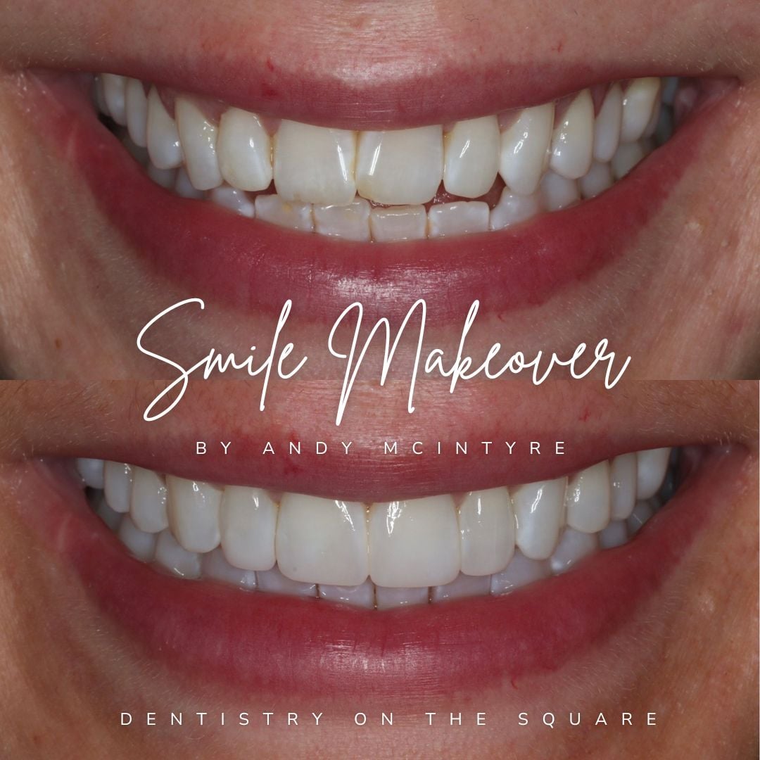 Dentistry On The Square, Pain Free Dentist Glasgow - Smile Makeovers in Glasgow