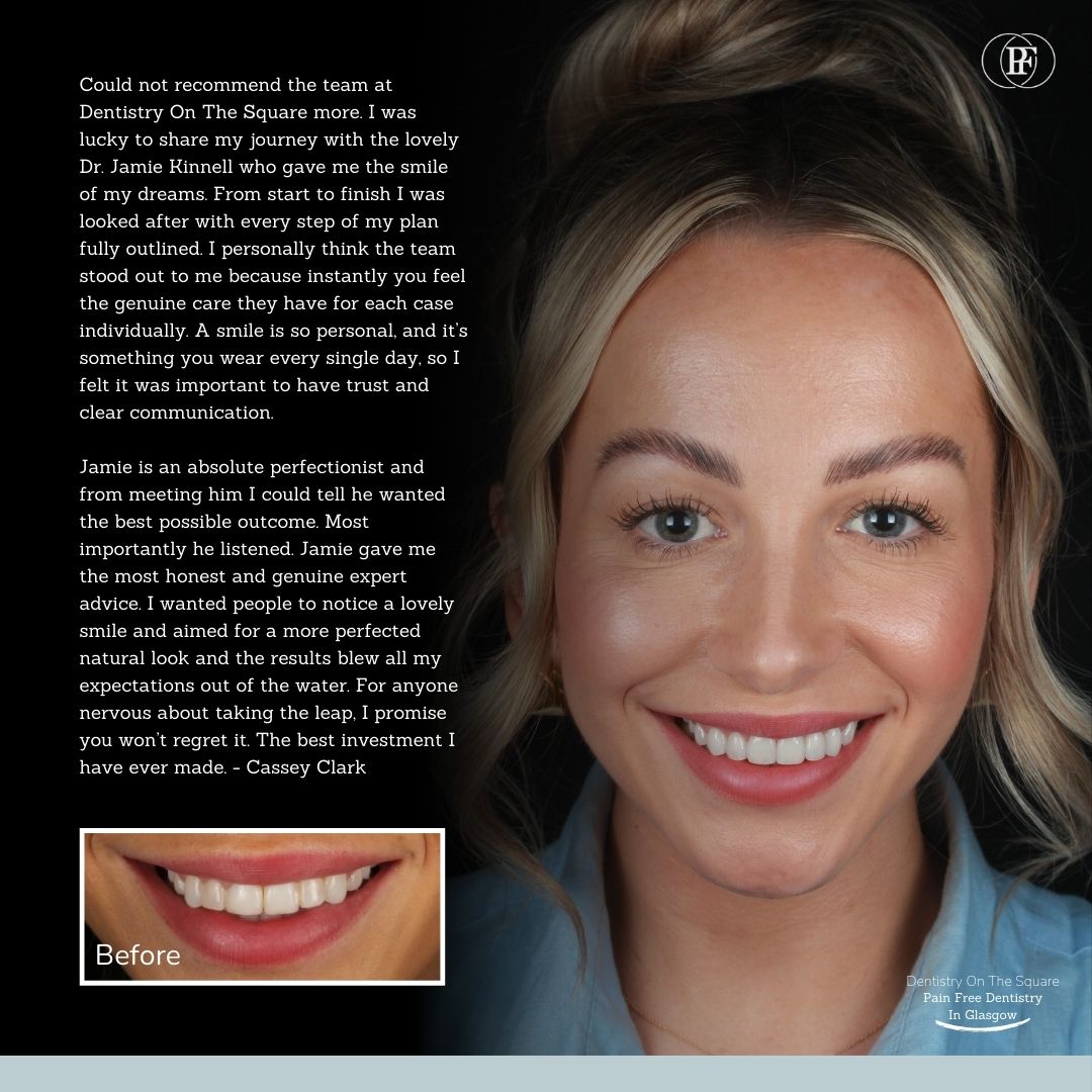 Jane's smile makeover