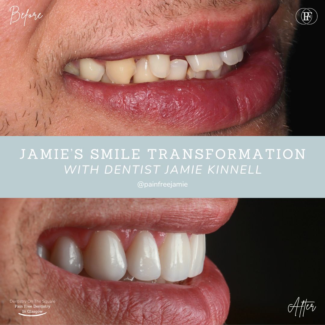 Dentistry On The Square, Pain Free Dentist Glasgow - Jamie's Smile Story
