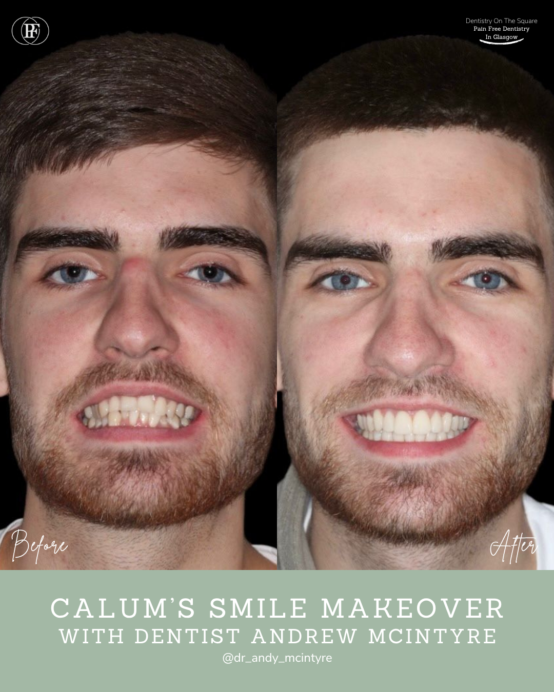 Ross's smile story
