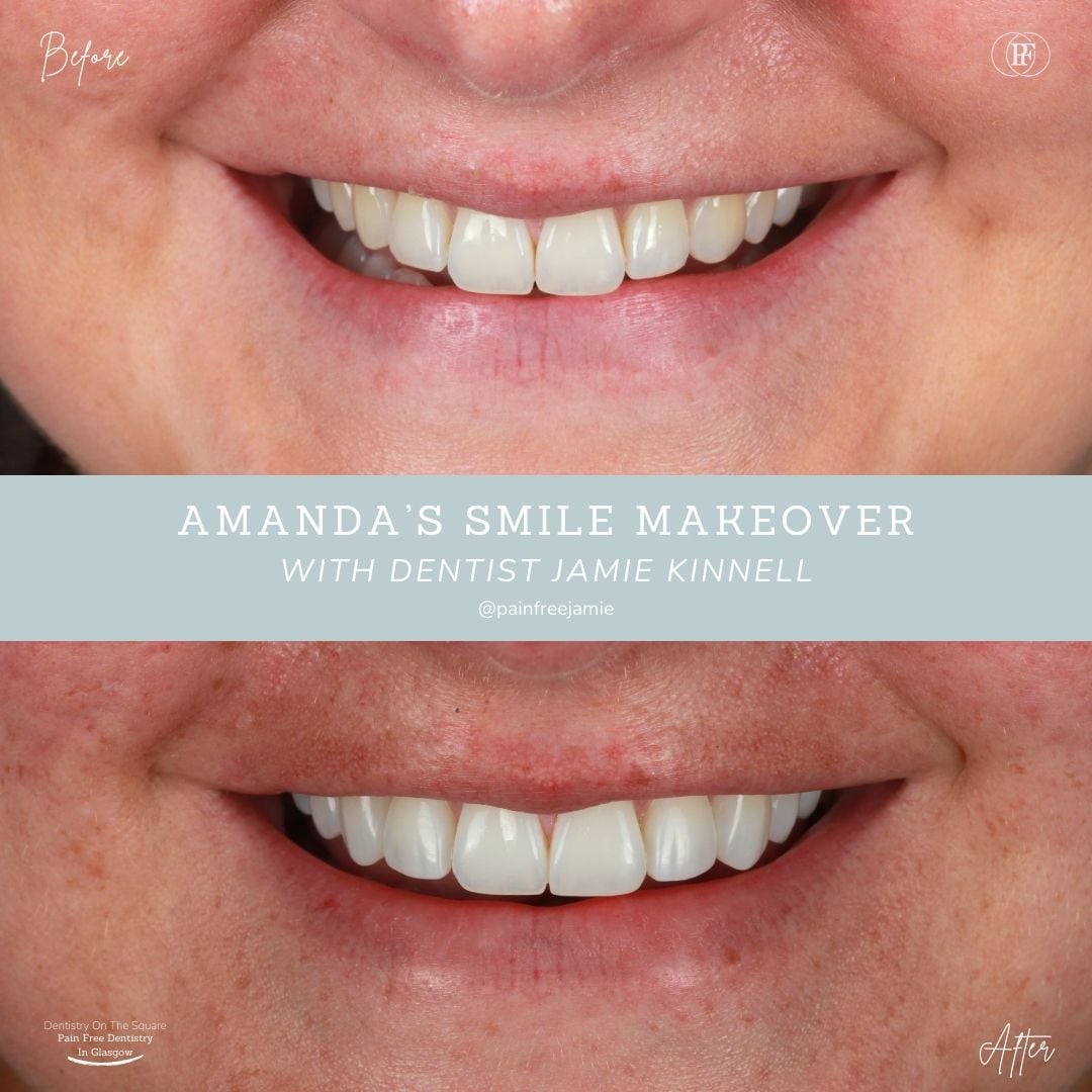 Amanda's Smile Story with Jamie Kinnell