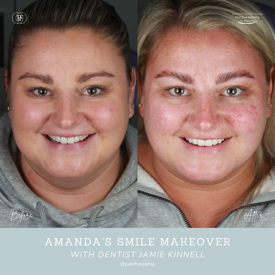 Dentistry On The Square, Pain Free Dentist Glasgow - Amanda's Smile Story