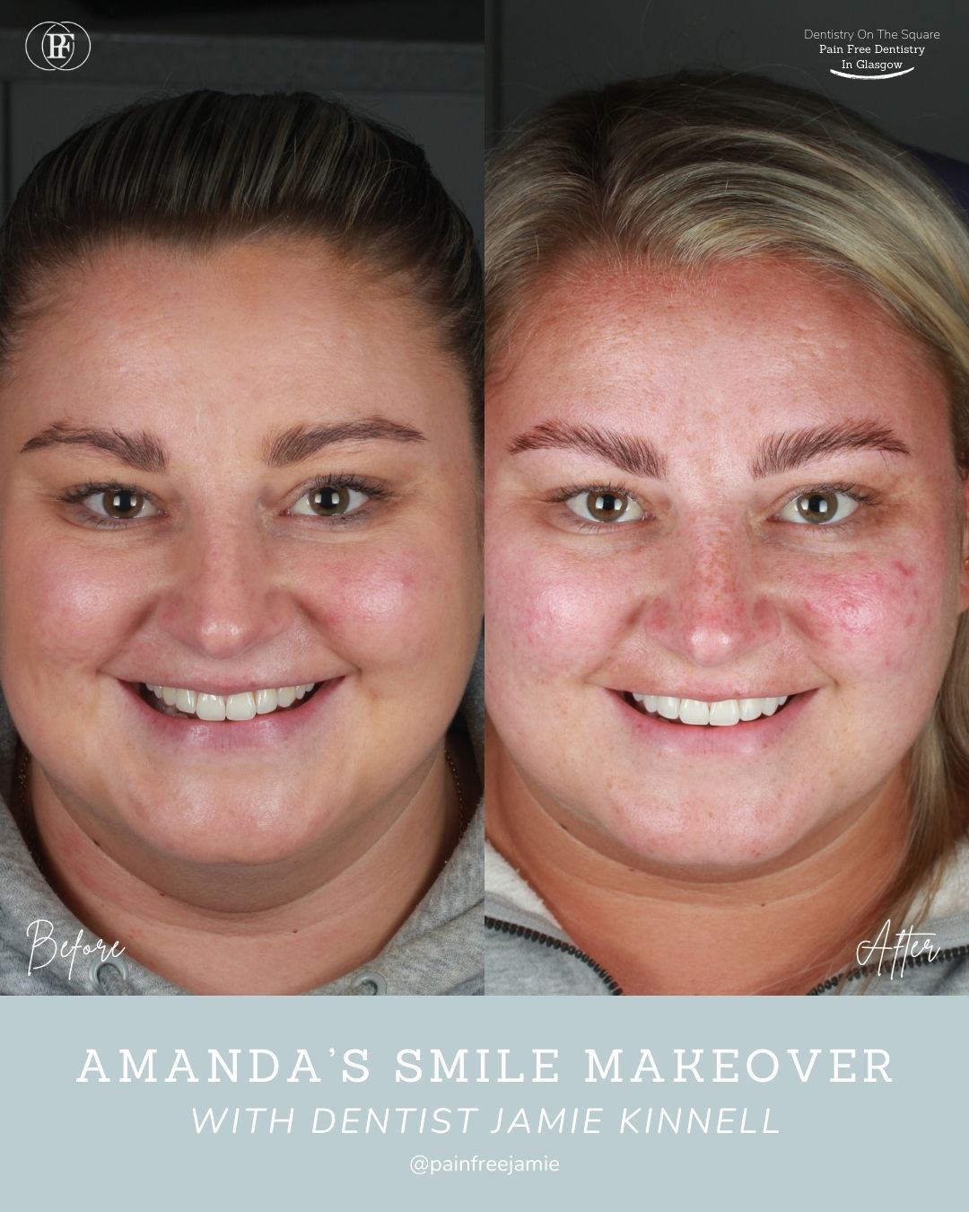 Amanda's Smile Story