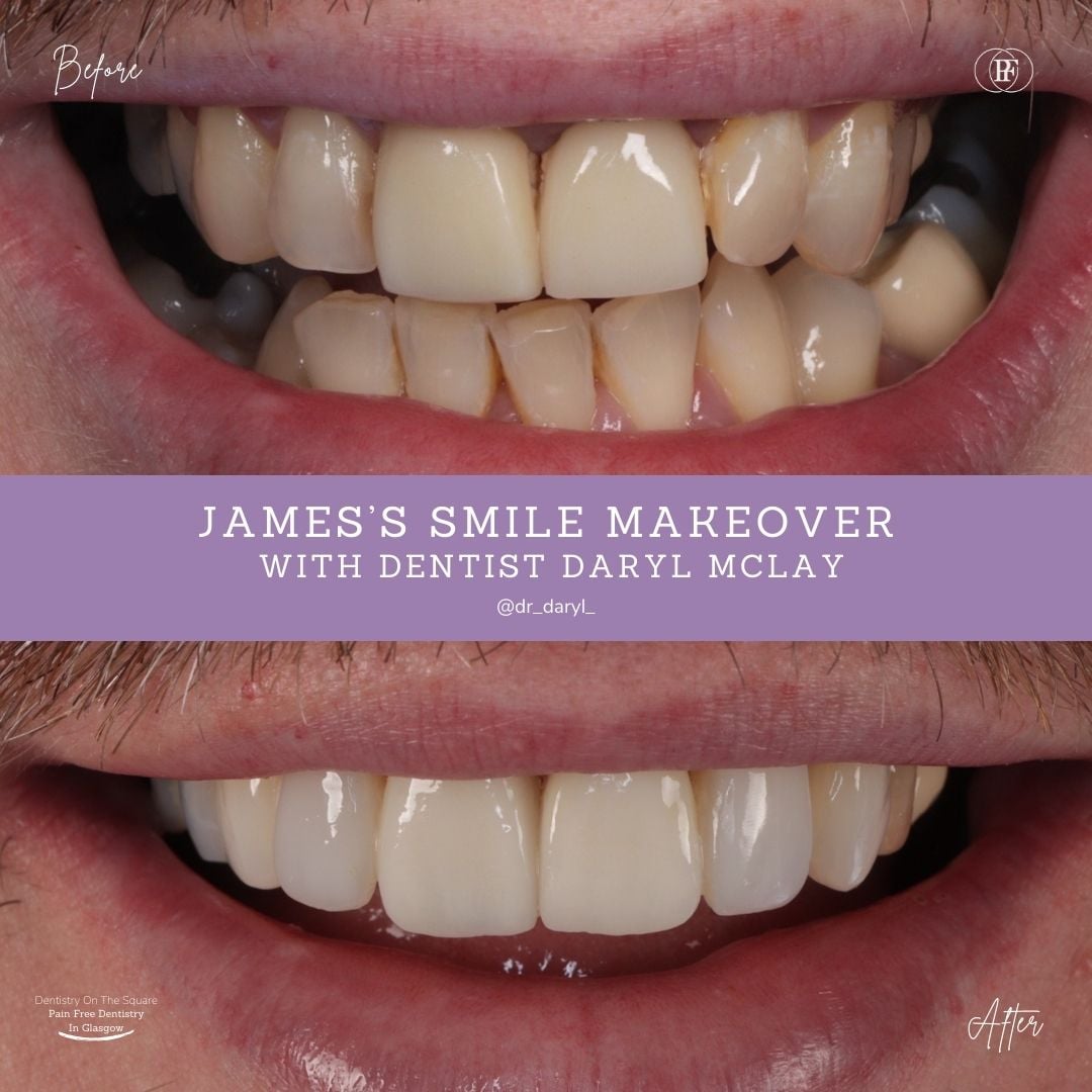 James' Smile Story with Daryl