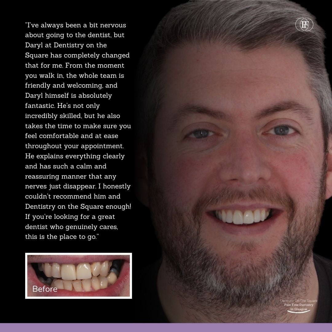 James' Smile Story with Daryl