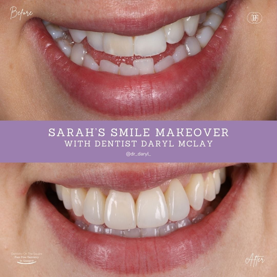 Sarah's Smile Story with Daryl