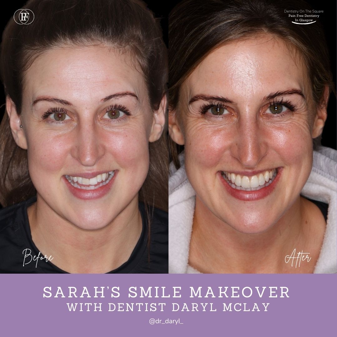 Dentistry On The Square, Pain Free Dentist Glasgow - Sarah's Smile Story