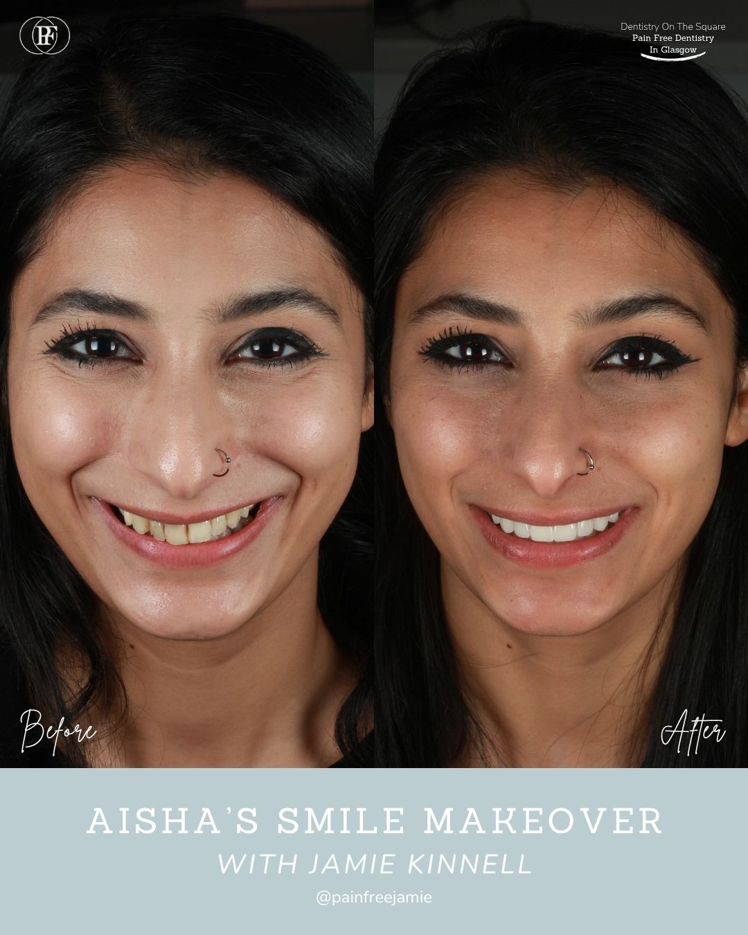 Aisha's  Smile Story