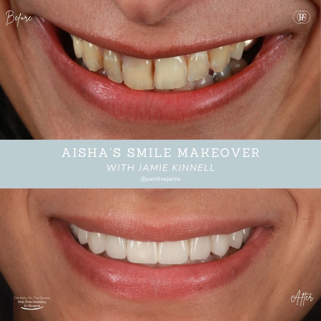 Dentistry On The Square, Pain Free Dentist Glasgow - Aisha's Smile Story Aisha's Smile Story with Andy