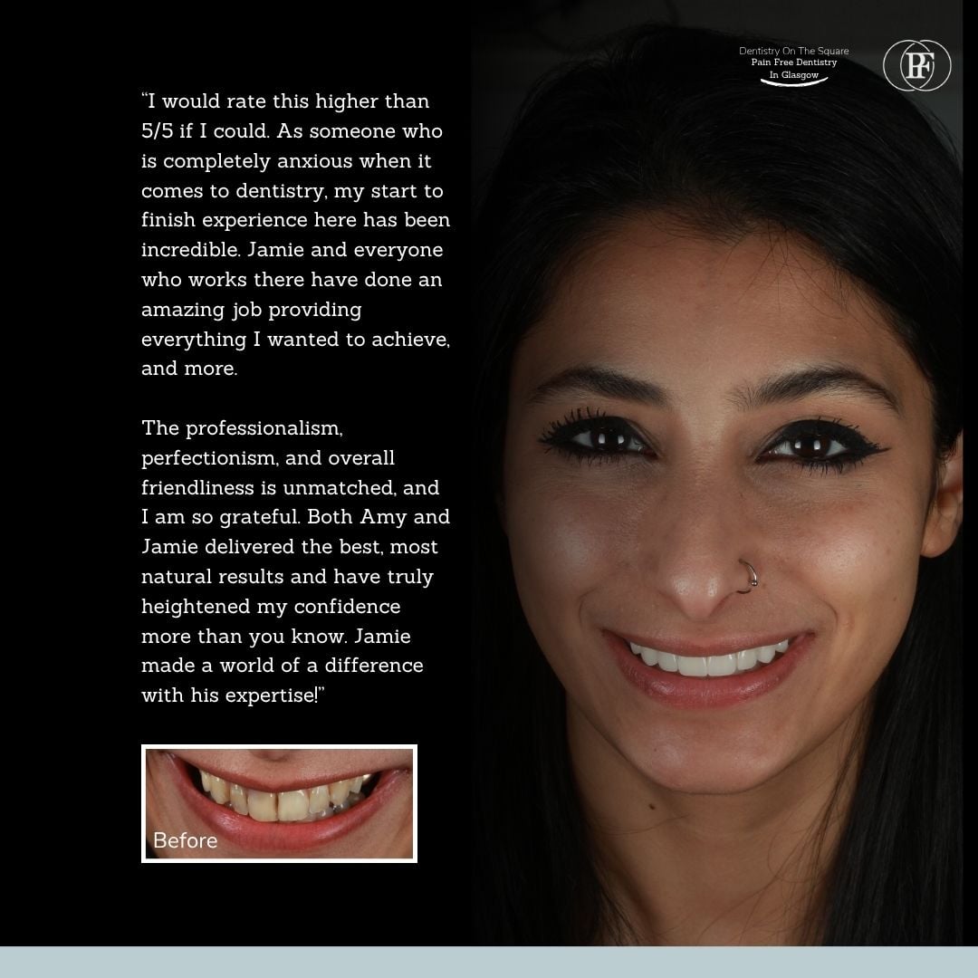 Dentistry On The Square, Pain Free Dentist Glasgow - Aisha's Smile Story Ross's smile story