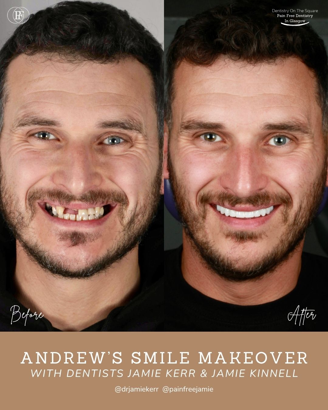Andrew's Smile Story