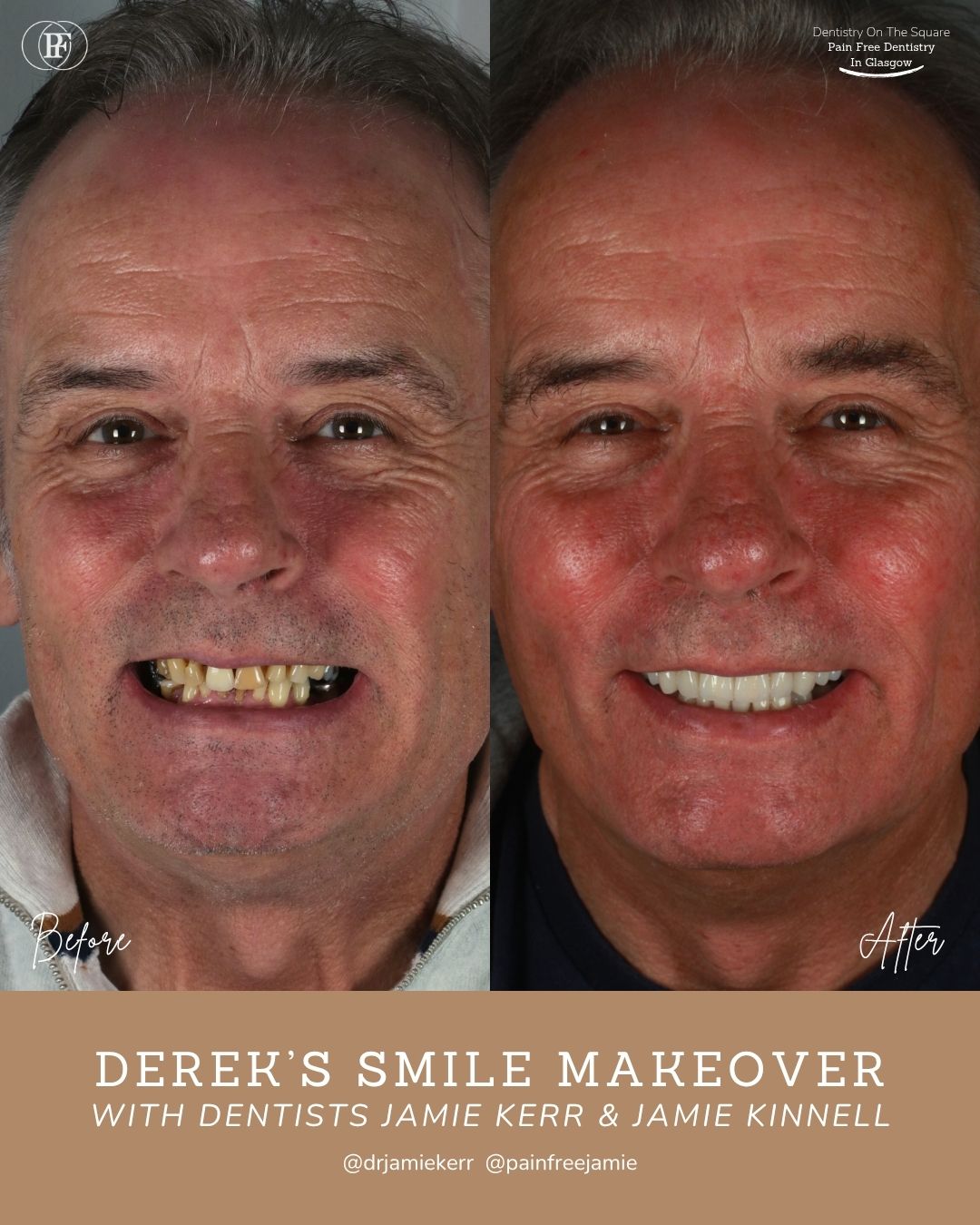 Derek's  Smile Story